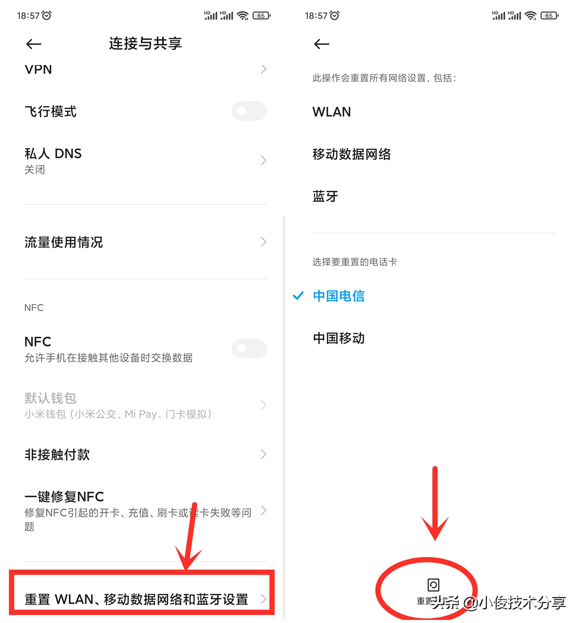 为什么手机打不开网页（手机wifi已连接但是无互联网连接）(3)